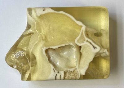 3DPrint facebones