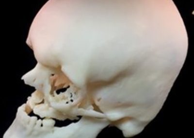 3DPrintSkull