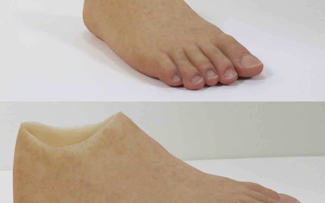 Foot Prosthesis