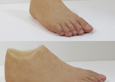 Foot Prosthesis
