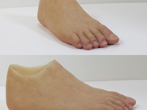 Foot Prosthesis