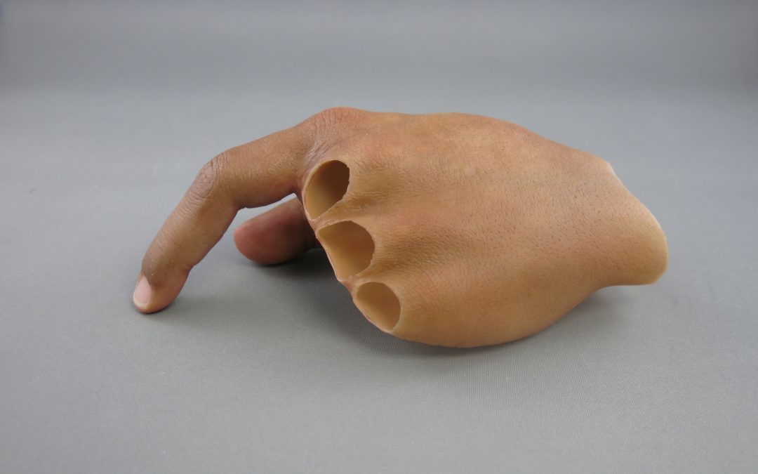 Hand Prosthesis