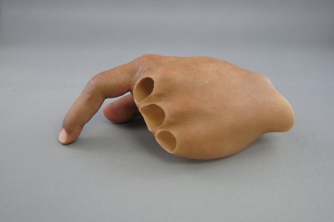 Hand Prosthesis Dorsal 2 scaled
