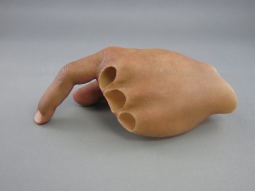 Hand Prosthesis