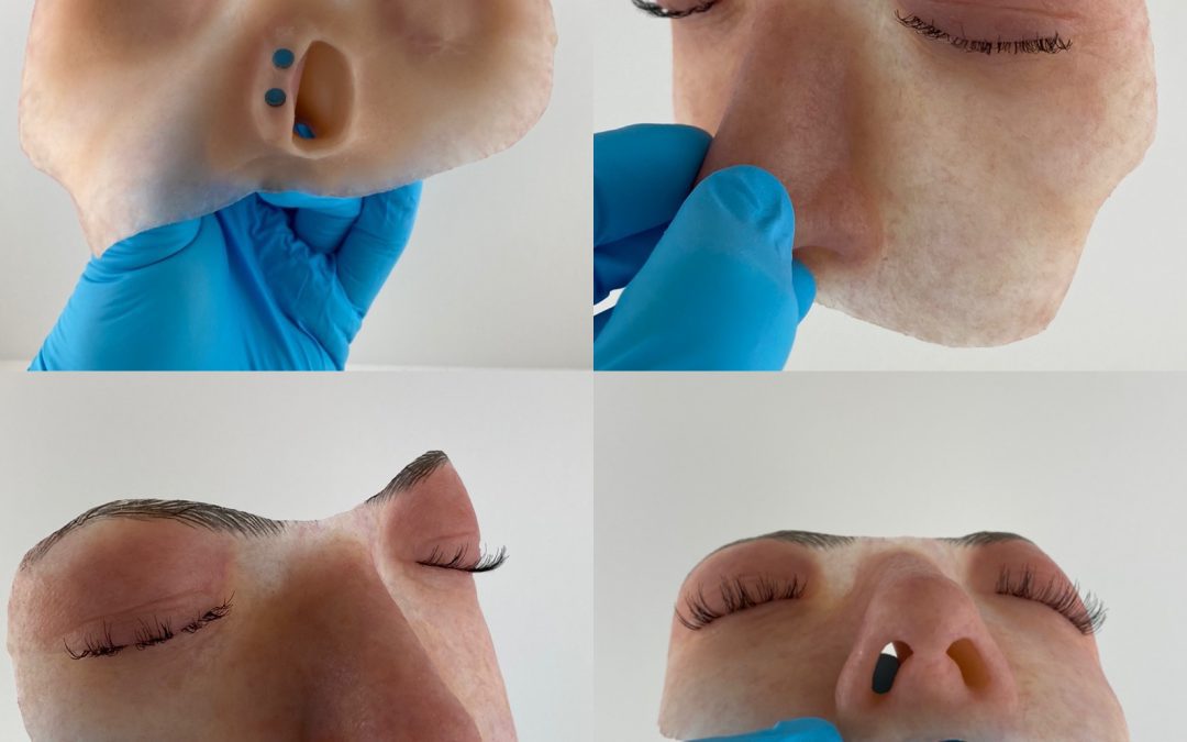 Hemifacial prosthesis