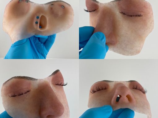 Hemifacial prosthesis