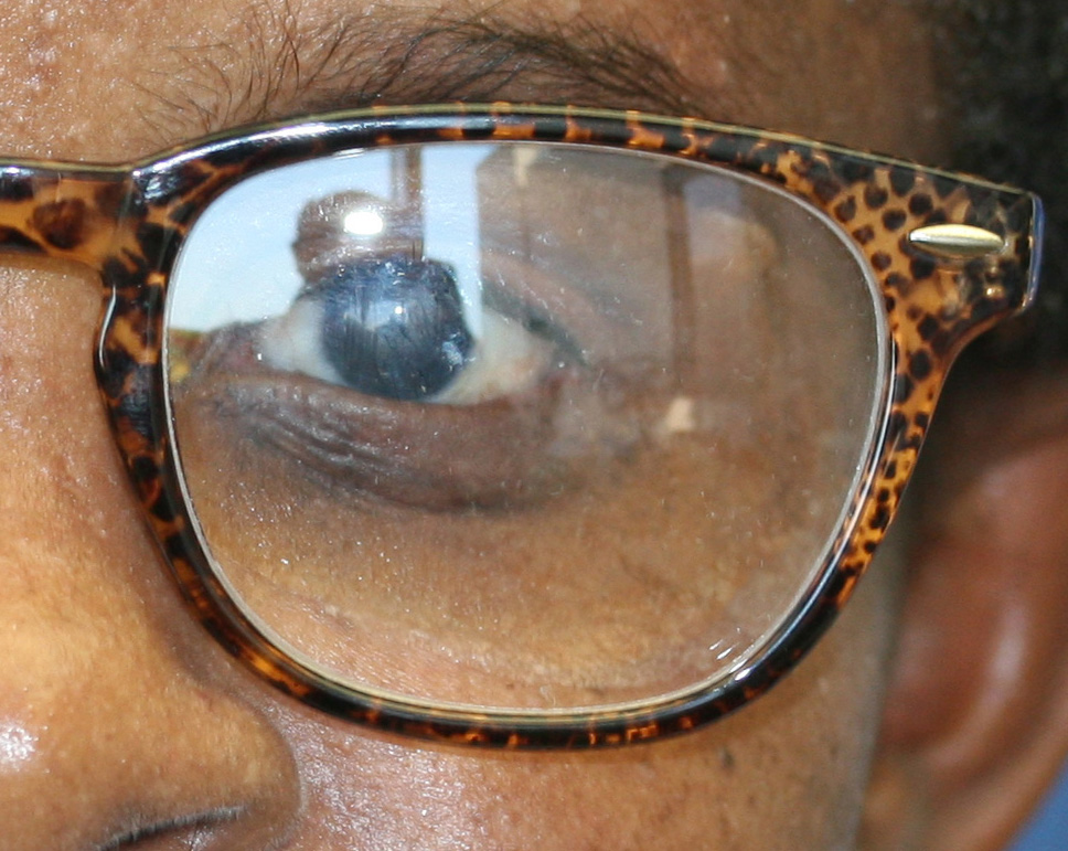 Eye Prosthesis
