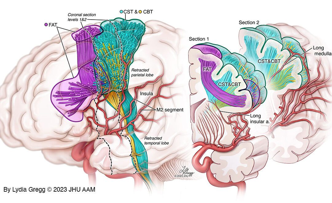 Motor Tracts of the Brain