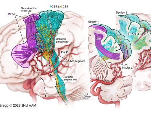 Motor Tracts of the Brain