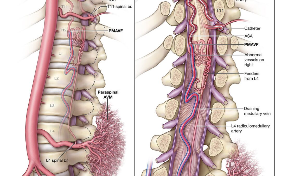 Arterial anatomy of the perimedullary spine