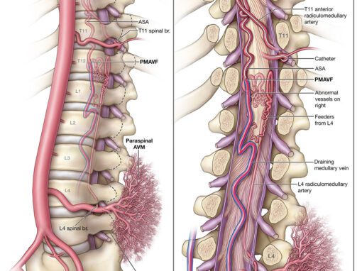 Arterial anatomy of the perimedullary spine