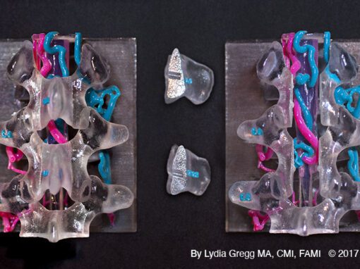 Perimedullary spinal neurovascular anatomical model