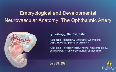 Lydia Gregg Invited Speaker at the Society of Neurointerventional Surgery Annual Meeting