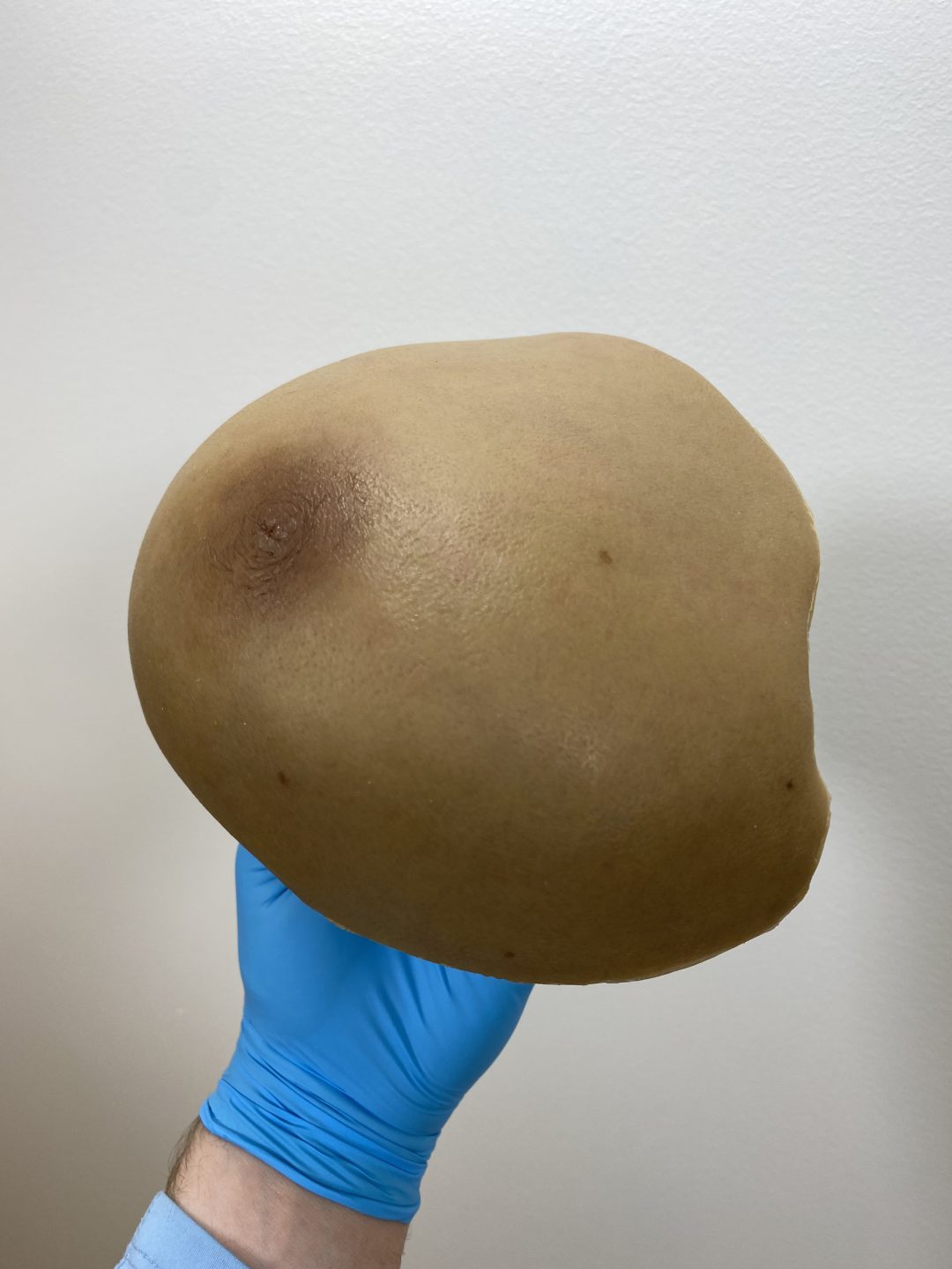 Mastectomy Prosthesis scaled