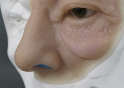 Nasal Orbital Ocular scaled