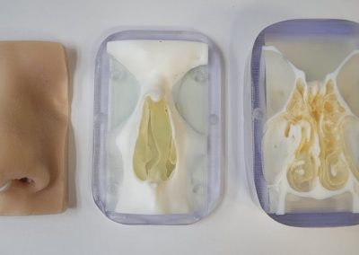 NoseMolds