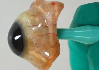 Ocular Post