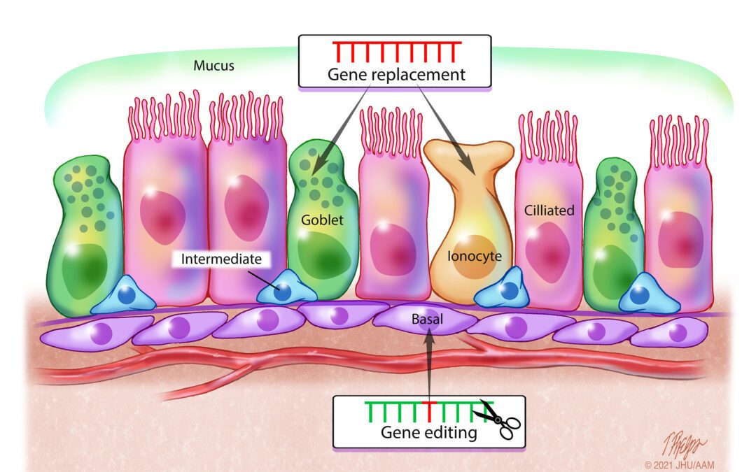 Cell Gene Therapy