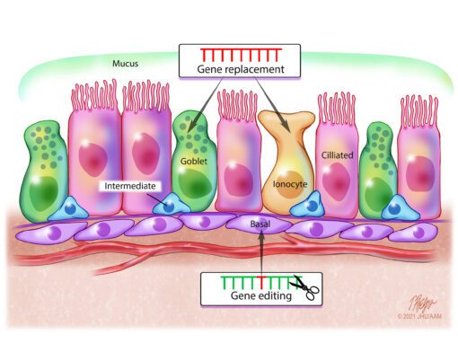 Cell Gene Therapy