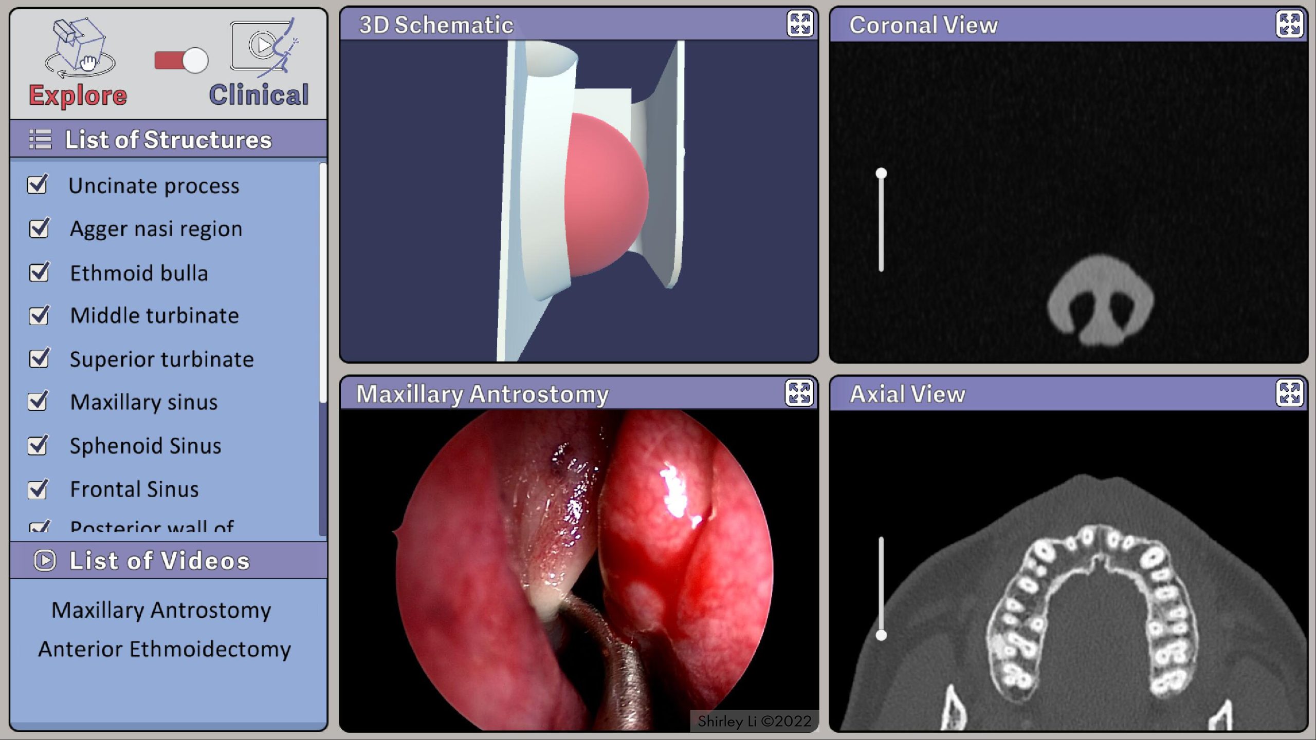 Sinonasal Cavity Interactive © 2022 Shirley Li