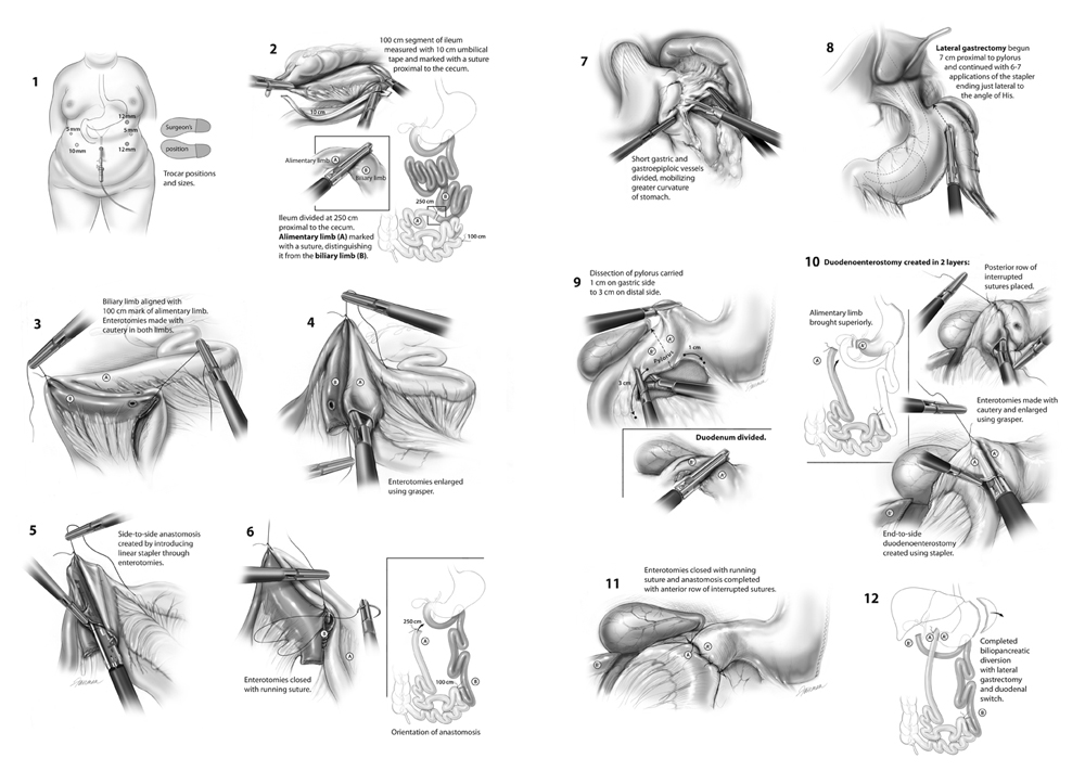 jfairman biliopandiversion1