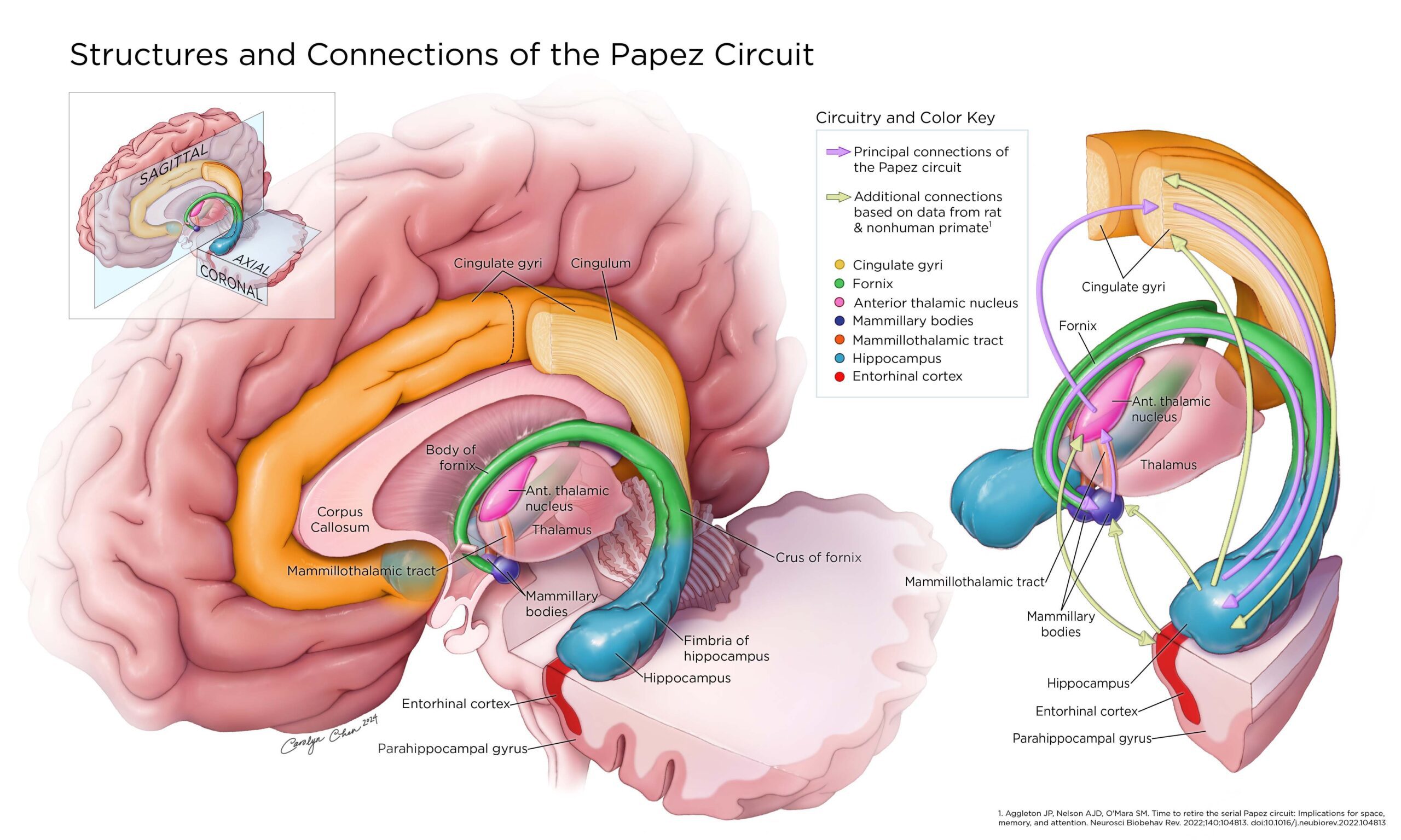 Sketch of surgery - parotidectomy
